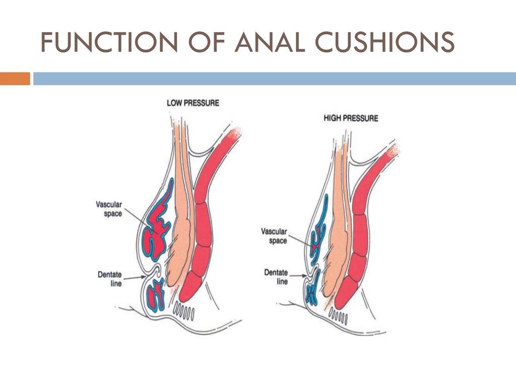  Open surgery Hernia